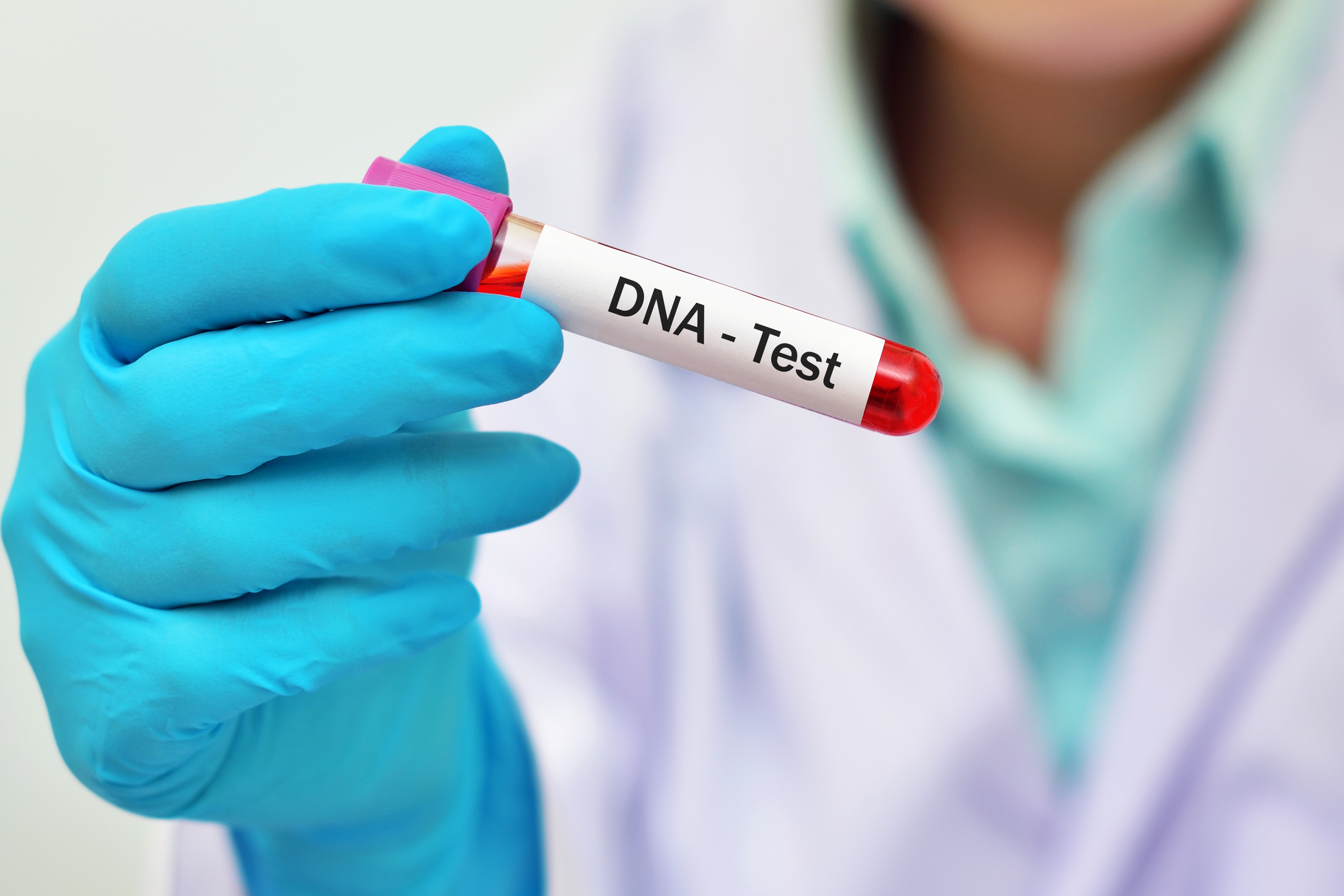 Dna testing. DNA Test. ДНК В пробирке. СПИД врач.